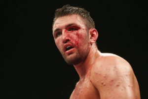 Hughie Fury gets opponent for May 25 return