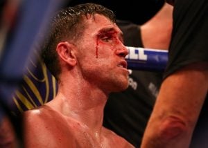 Callum Smith: If Anfield Is Possible, I Must Be Better