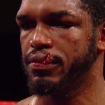 Jaime Munguia stops Tureano Johnson after round 6 due to freak lip cut