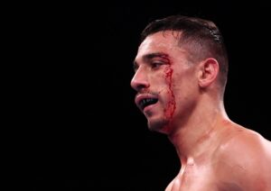 Luis Alberto Lopez: Warrington is Very Dirty, I'd Never Fight Him Again