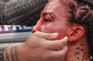 Caroline Dubois vs. Jessica Camara ends in disappointing technical draw