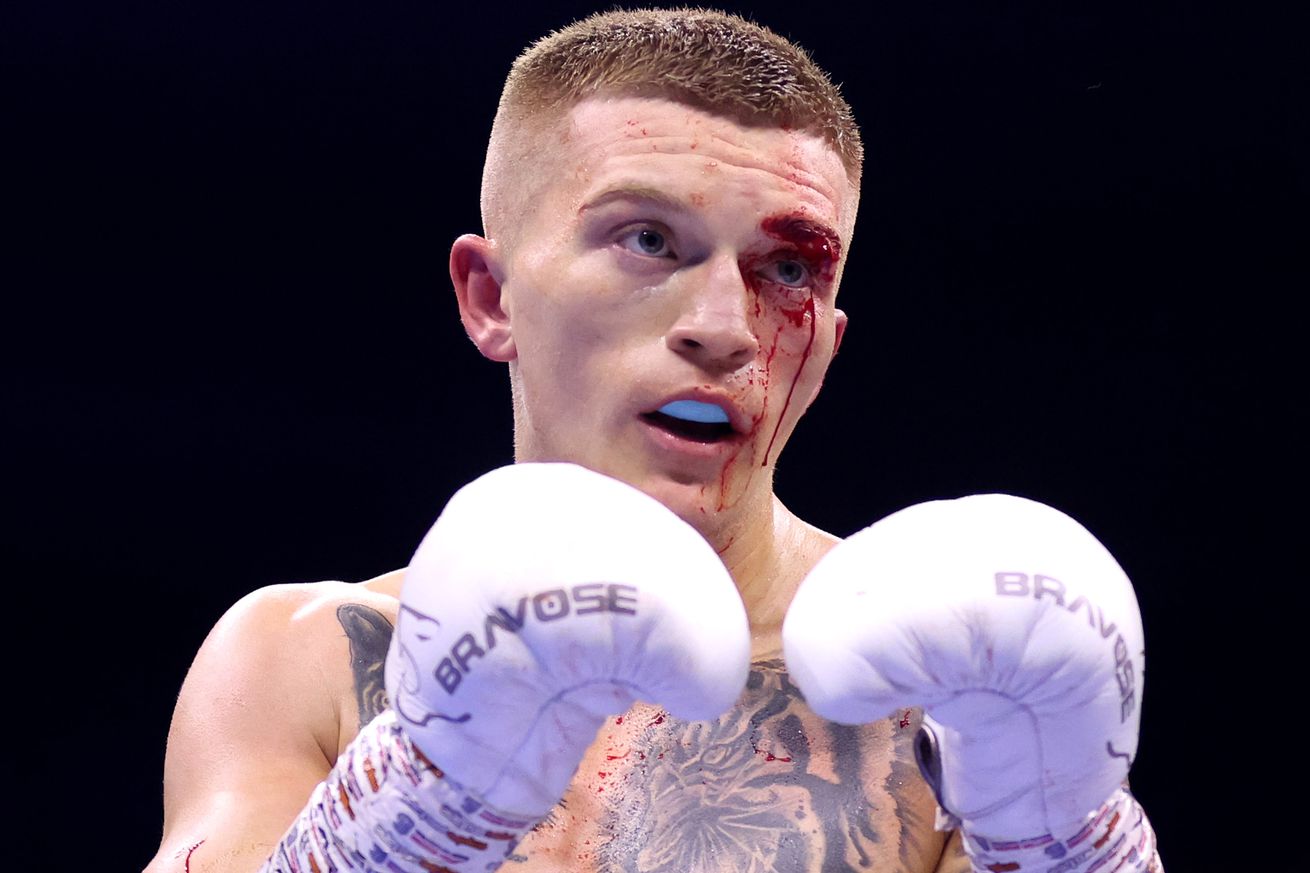 ‘Campbell won’t fight again’: Ricky Hatton says son has retired