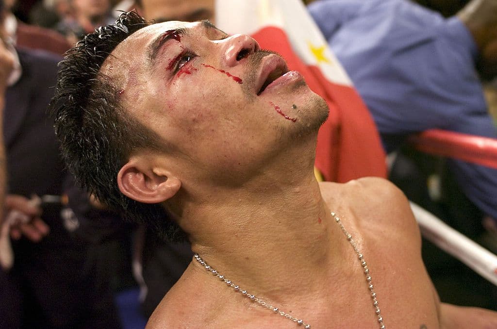 Manny Pacquiao Believes He's The Greatest Fighter Of All Time