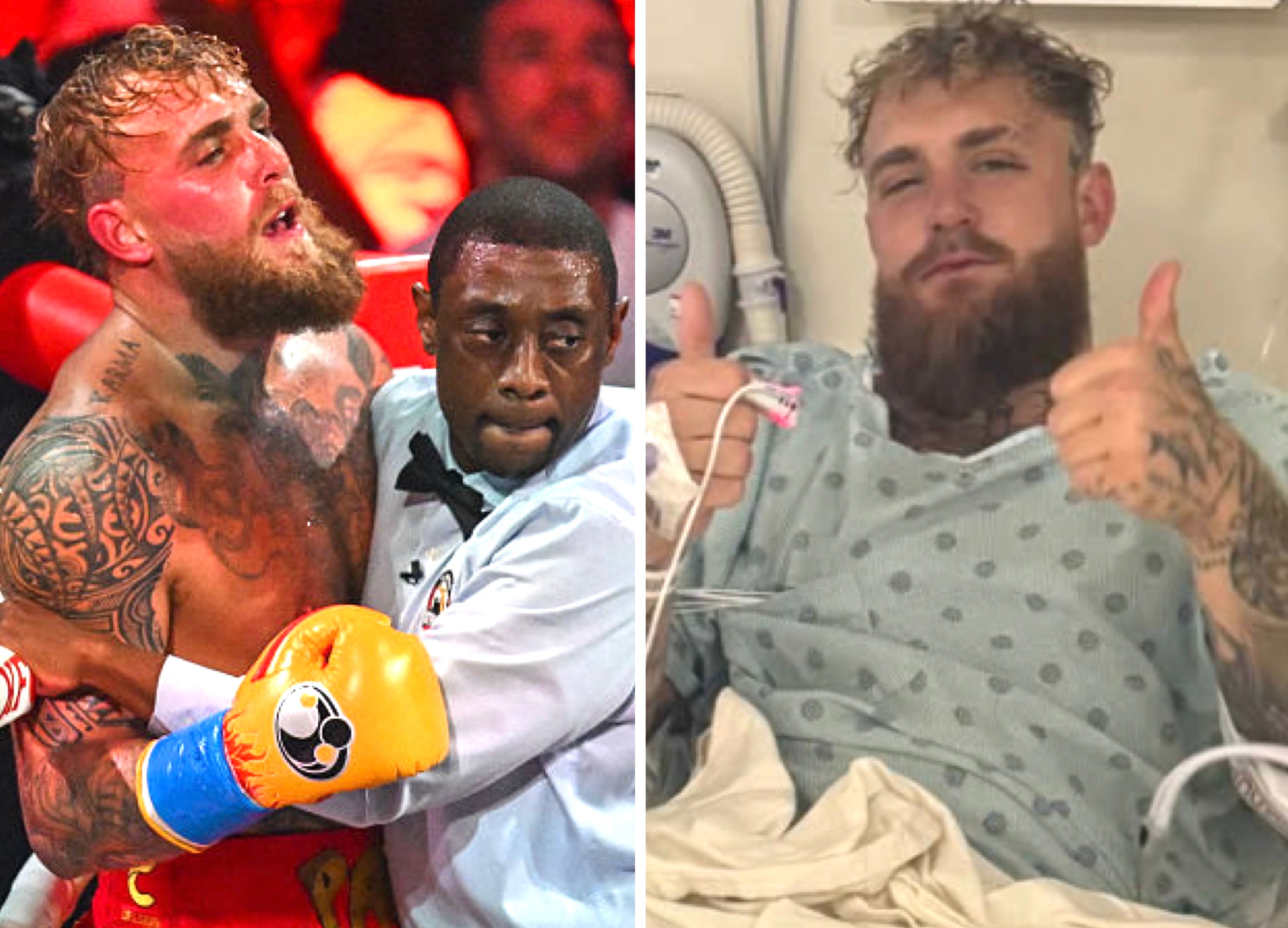 Jake Paul undergoes surgery for broken jaw after Anthony Joshua KO defeat
